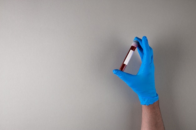 Фото Рука в синей резиновой стерильной перчатке держит пробирку с образцом на абстрактном сером фоне