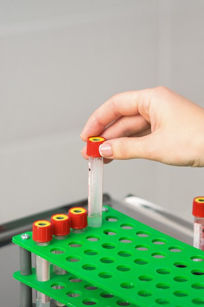 Hand of lab technician or nurse takes empty blood test tube from rack in the research laboratory