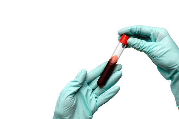 Hand in latex glove holding blood sample in test tube close up isolated on white background.