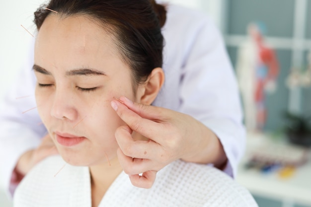 Hand van arts die acupunctuurtherapie uitvoert. Aziatische vrouw acupunctuur behandeling met een lijn van fijne naalden ingebracht in de huid van haar gezicht in kliniek ziekenhuis