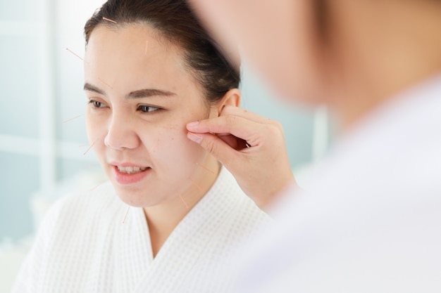 Hand van arts die acupunctuurtherapie uitvoert. Aziatische vrouw acupunctuur behandeling met een lijn van fijne naalden ingebracht in de huid van haar gezicht in kliniek ziekenhuis