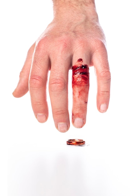 Рука с окровавленным пальцем и обручальным кольцом