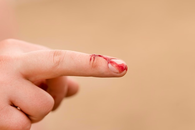 Hand with bloody middle finger on blurred beige background