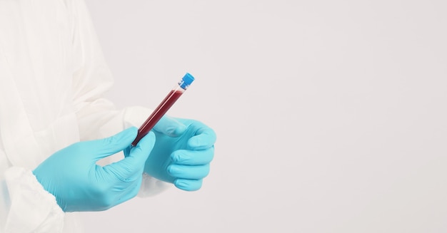 Hand with blue medical glove is holding blood collection tube on white background.Man wear PPE suit