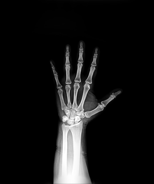 뼈가 있는 손과 숫자 3이 있는 손
