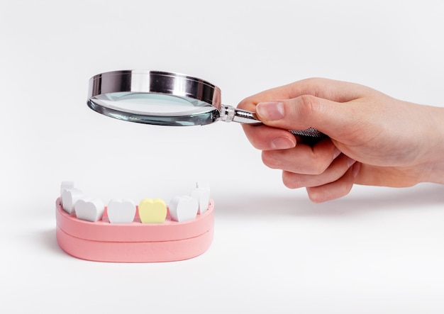 Mano con lente d'ingrandimento sul dente malato con cavità della placca controllo dei denti diagnosi dei problemi di salute dentale e trattamento delle malattie gengivali da carie