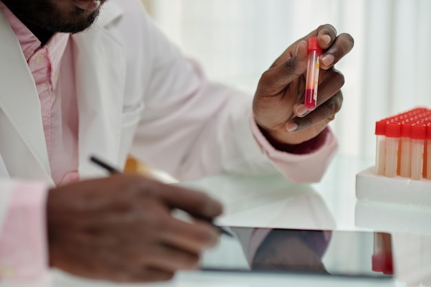 Hand of young african american clinician holding flask with blood sample while studying characterist