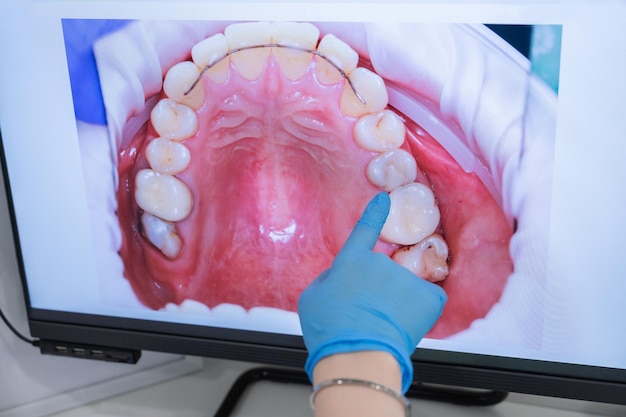 Handen van arts-tandarts in handschoenen tonen de tanden op het digitale scherm in de tandheelkundige kliniek