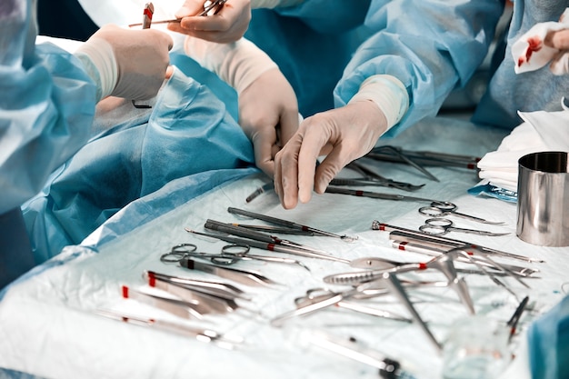 Handen van een team van chirurgen close-up in de operatiekamer tijdens de operatie, steriele instrumenten liggen op de tafel in de operatiekamer.