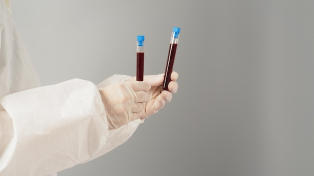 Hands are holding two blood test tubes on grey background Hand wears a PPE suit and a white medical glove