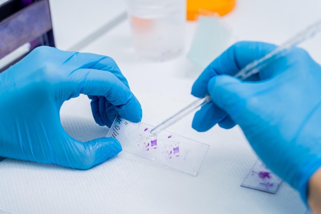 Hands in blue glove holding glass histology slides