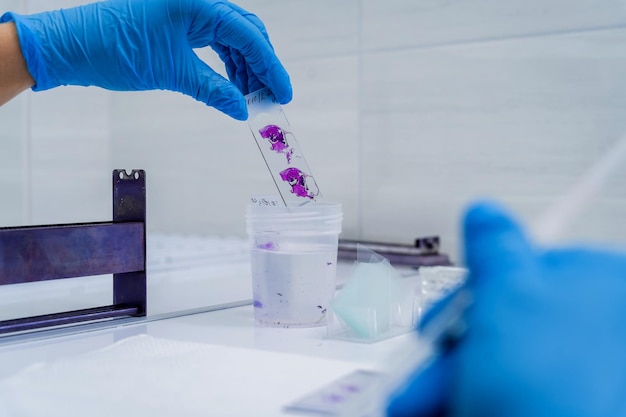 Hands in blue glove holding glass histology slides