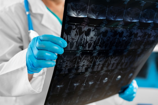 Hands of a doctor holding head mri scan close up