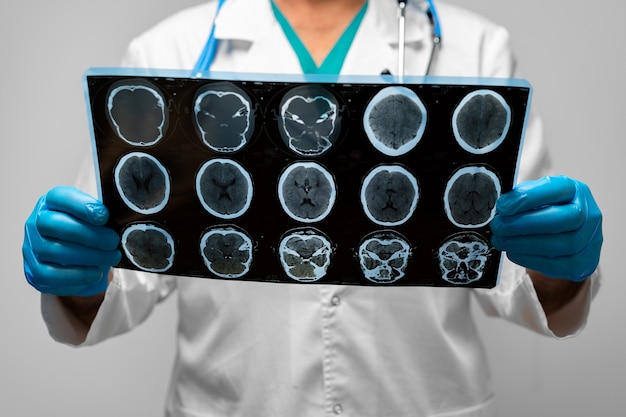 Hands of a doctor holding head mri scan close up