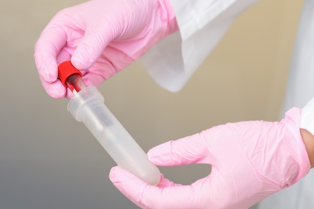 Hands of doctor holding test tube of blood.