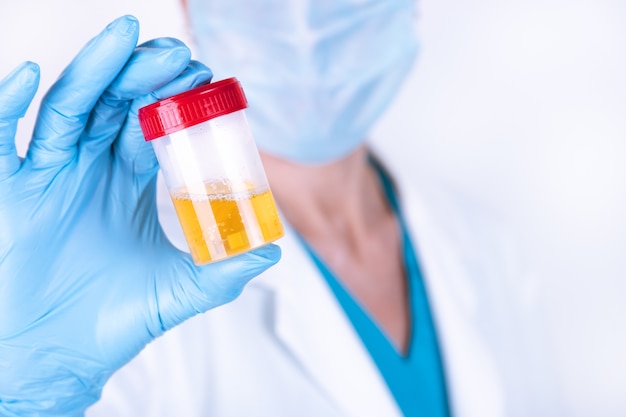 Hands of a doctor or nurse in blue gloves hold a container with a urine test 