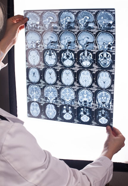 hands of a doctor woman holding mri of a human brain
