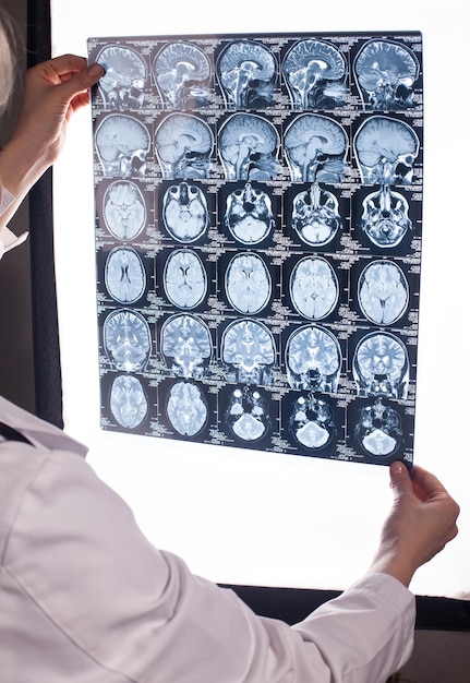 Hands of a doctor woman holding mri of a human brain