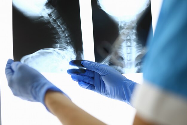 Hands in gloves holding radiography of bones