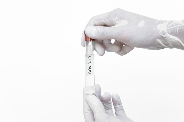 Foto mani che tengono il vaccino immunitario contro il virus corona