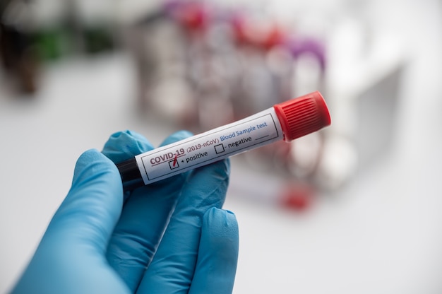 Hands of a lab technician with a tube of blood sample and a rack with other samples / lab technician holding blood tube sample for study