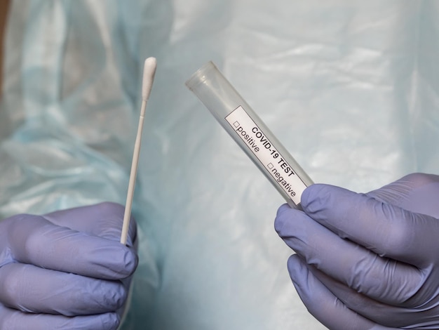 Hands in medical gloves holding an oral sample swab and a test tube for covid tests