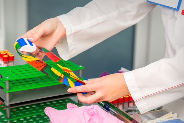 Hands of nurse prepare medical tourniquet for blood sampling in medical office