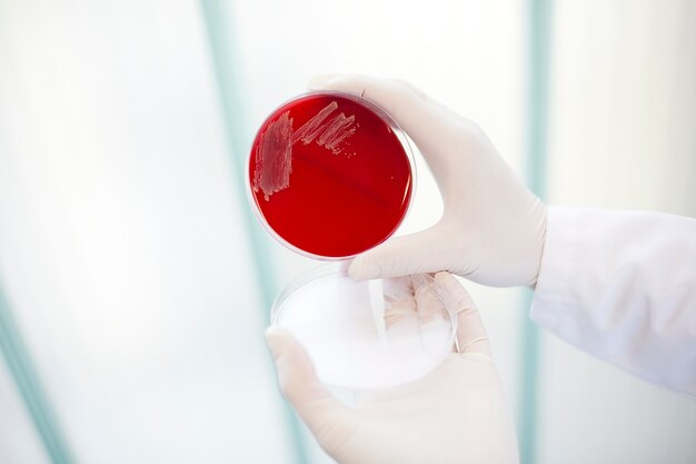 Hands of a scientist holding a red cultivation tray