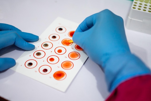 Photo hands wearing rubber gloves mixing blood with serum when testing blood types in the lab