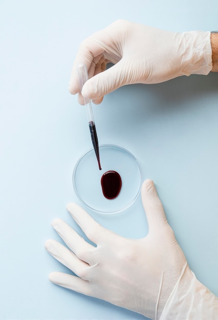 Photo hands with gloves and sample of blood