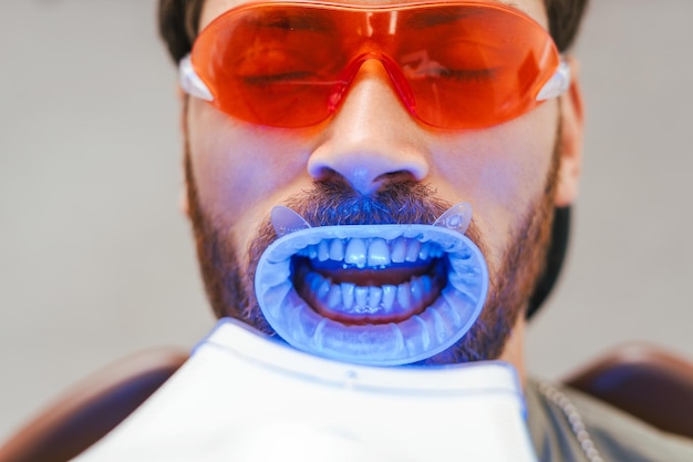 Handsome bearded man patient whitening teeth in modern dental clinic Teeth treatment health care