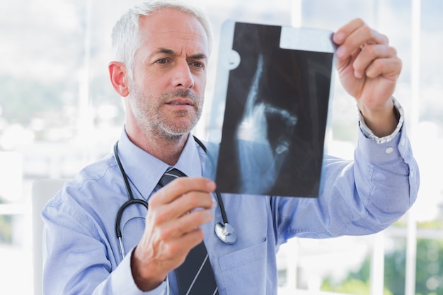 Photo handsome doctor examining an x-ray