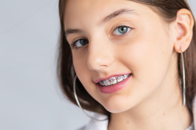 Happy young woman face Girl with braces on teeth on white banner background