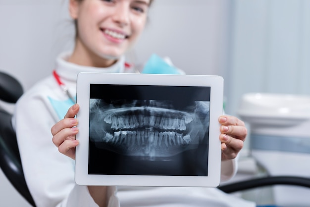 Photo happy young woman showing her teeth x-ray