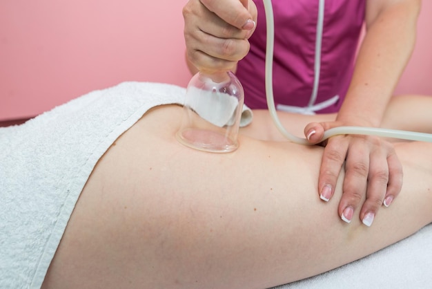 Аппаратная косметология Процедура вакуумного массажа в медицинском центре красоты Крупный план антицеллюлитной баночной терапии молодой женщины