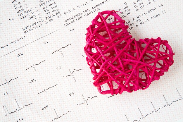 Foto hart- en elektrocardiogramopname