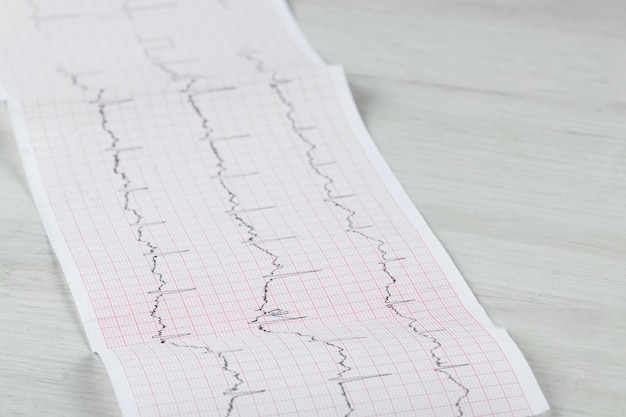 Hartelektrocardiogram ecg-grafiek op speciaal papier. concept voor hartscan, ziektekostenverzekering, medische achtergrond, onderzoek.