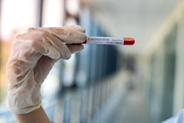 Healthcare worker in protective gloves holds a test tube with blood