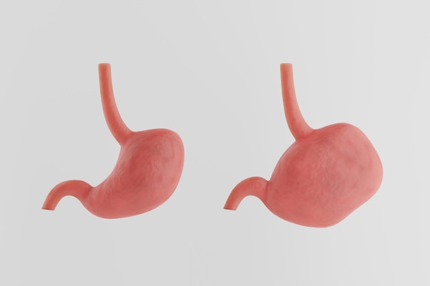 흰색 배경에 건강하고 아픈 위 과식 팽만감 개념 3D 렌더링