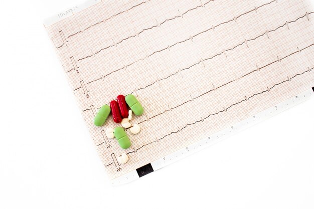 Photo heart electrocardiogram