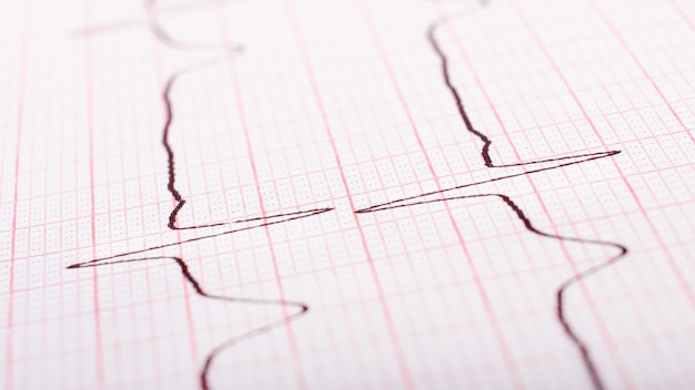 Heart rate on paper cardiogram closeup.