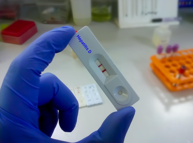 Hepatitis d rapid antigen test