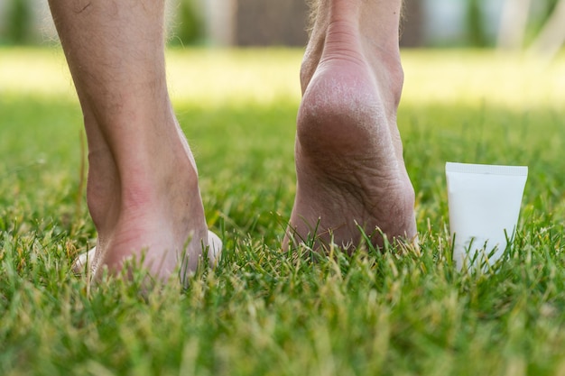 Foto heren hakken voeten met droge huid en schilferige met crème op gras