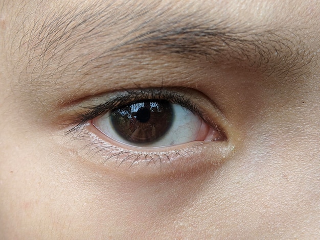 Het bruine oog van een jongen met een blauw oog