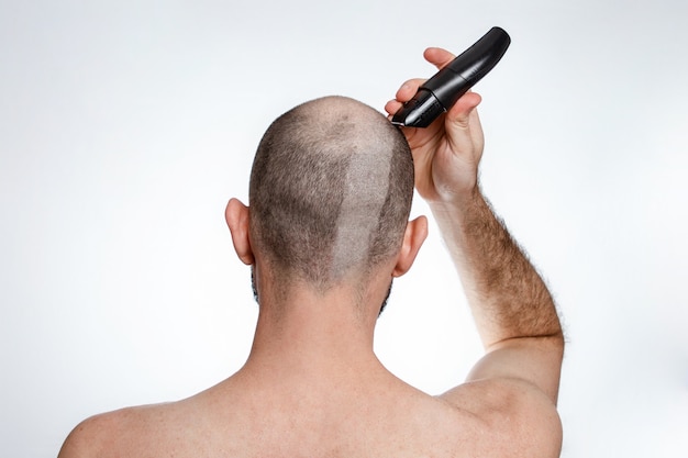 Het concept van kaalheid en alopecia. Een man houdt een tondeuse vast en scheert het haar bovenop zijn hoofd. Het uitzicht vanaf de achterkant. Ruimte kopiëren