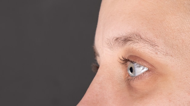 Het oog van een vrouw gediagnosticeerd met keratoconus, corneadystrofie.