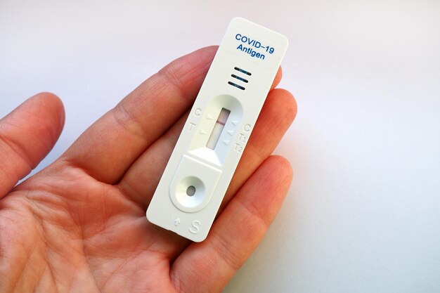 Het testresultaat voor COVID-19 is negatief, niet geïnfecteerd, met behulp van sneltestapparatuur. Test voor coronavirus op de hand, witte achtergrond. Ruimte kopiëren. Testconcept Coronavirus Ziekte-infectie.