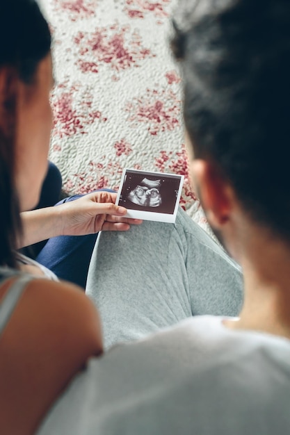 High angle view of couple looking at ultrasound scan on bed