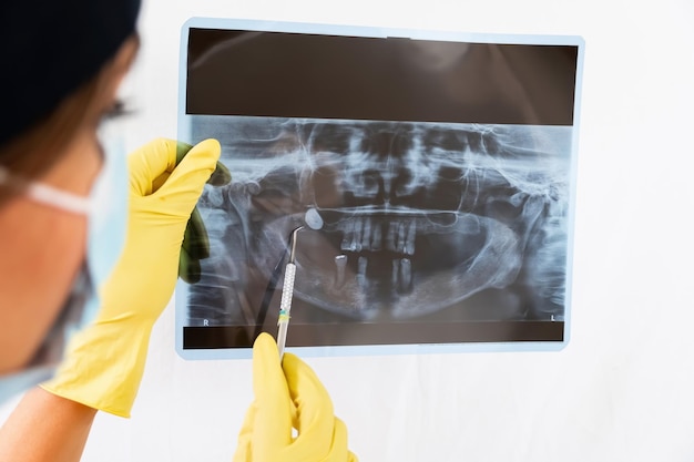 Foto hij xray is van een oude jonge mannelijke vrouw en legt de procedure uit