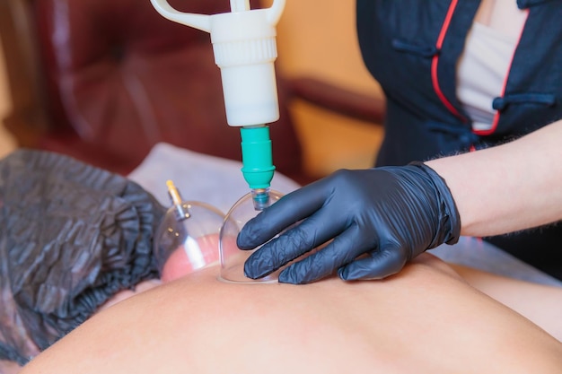 Photo a hijama master performs a vacuum blood suction procedure for a young girl